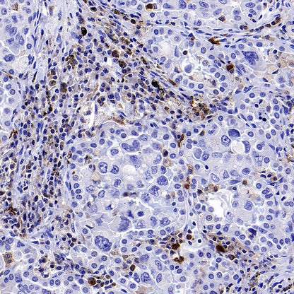 BTK Recombinant Rabbit mAb (SDT-2105-37)