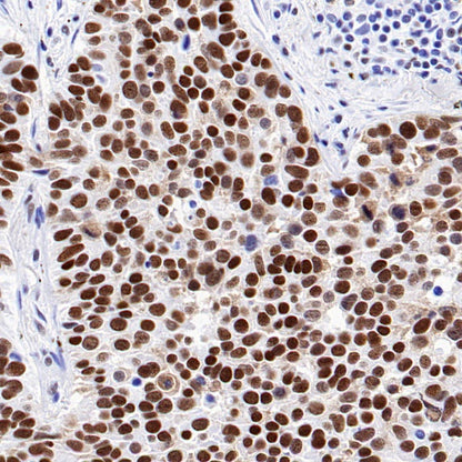 KDM1/LSD1 Recombinant Rabbit mAb (S-1280-80)
