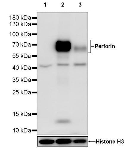 Perforin Recombinant Rabbit mAb (S-1944-68)