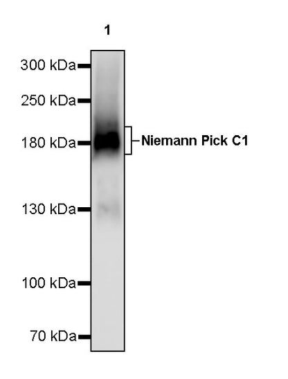 Niemann Pick C1 Recombinant Rabbit mAb (S-5243)