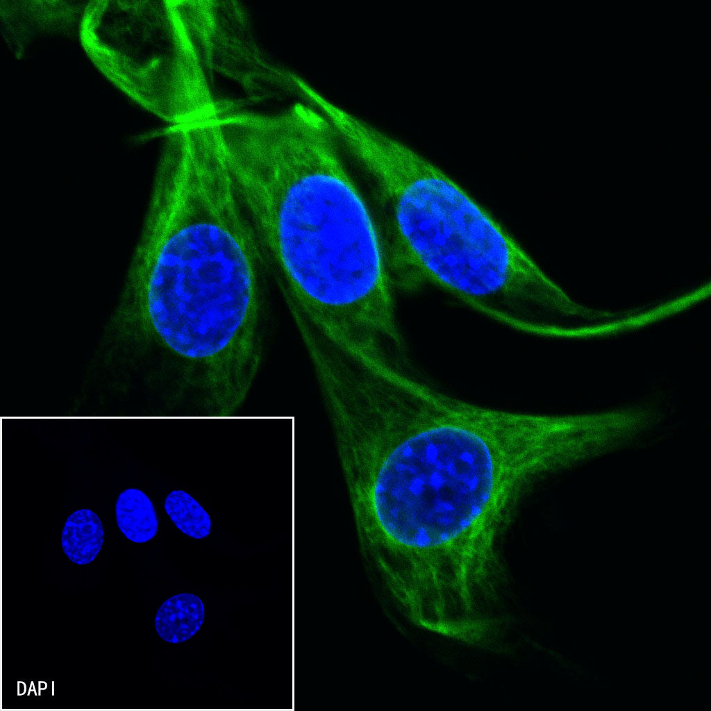 Vimentin Recombinant Rabbit mAb,PBS Only (SDT-029-20)