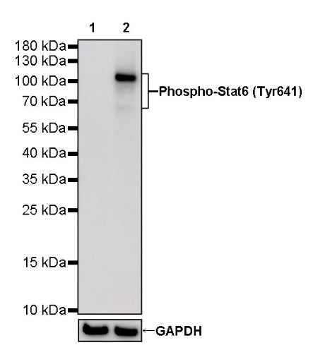 Phospho-Stat6 (Tyr641) Recombinant Rabbit mAb (S-1440-135)