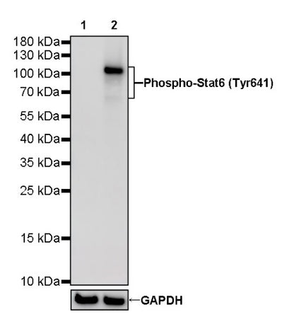 Phospho-Stat6 (Tyr641) Recombinant Rabbit mAb (S-1440-135)