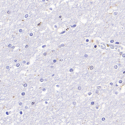 Cyclin B1 Recombinant Rabbit mAb (S-1407-224)