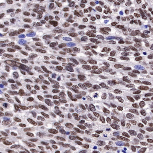 S-RMab® SOX10 Recombinant Rabbit mAb (SDT-R233)
