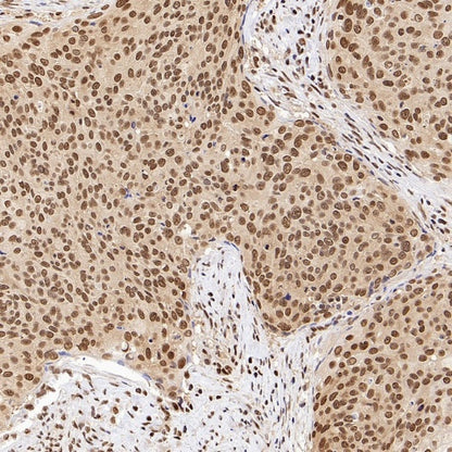 XPO1/CRM1 Recombinant Rabbit mAb (S-3309-7)