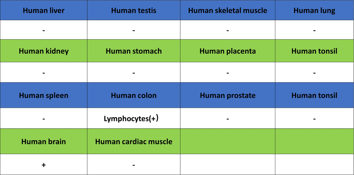 ADAM22 Recombinant Rabbit mAb (S-3201-8)