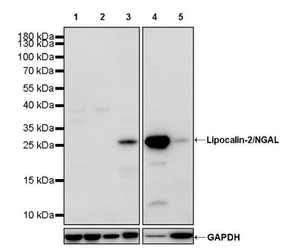 Lipocalin-2/NGAL Recombinant Rabbit mAb (S-2280-129)