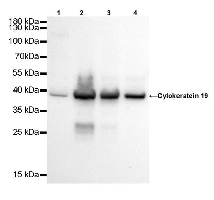 Cytokeratin 19 Recombinant Rabbit  mAb,PBS Only (SDT-107-19)