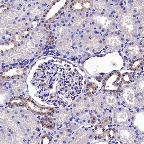 TSG101 Recombinant Rabbit mAb (S-1868-76)