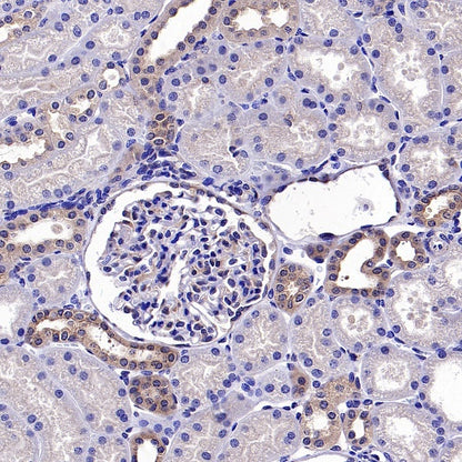 TSG101 Recombinant Rabbit mAb (S-1868-76)