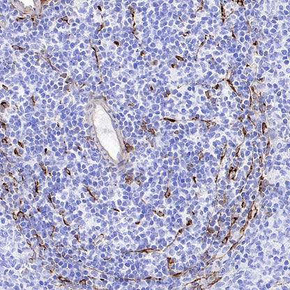 CCL21 Recombinant Rabbit mAb (S-3198-156)