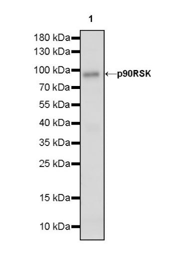p90RSK Recombinant Rabbit mAb (S-1024-26)