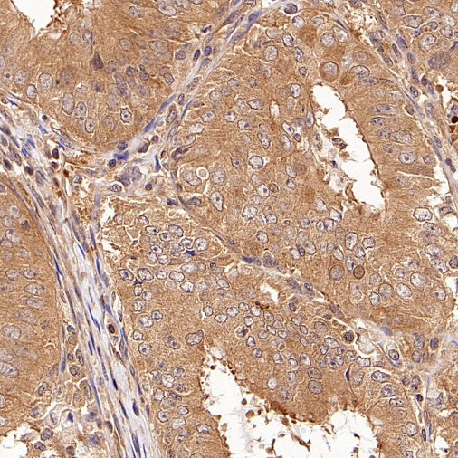 PPP2R1A Rabbit Polyclonal Antibody
