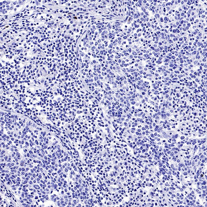 Napsin A Recombinant Rabbit mAb (SDT-2777-115)