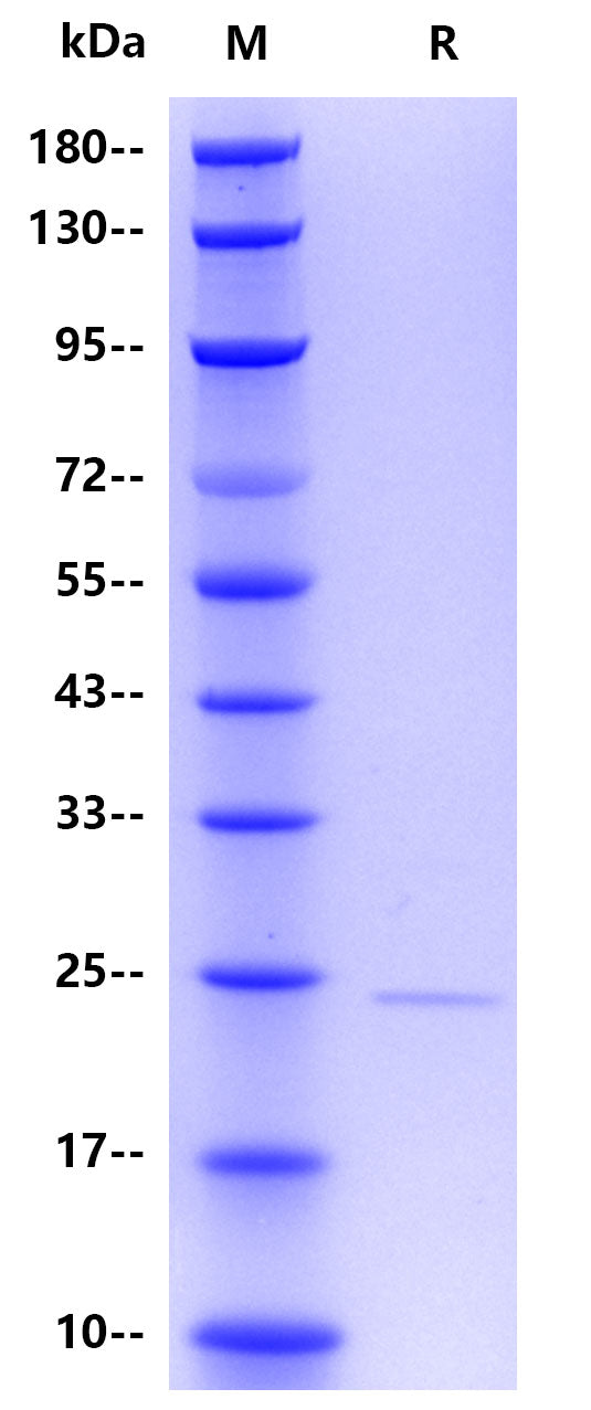 Human ferritin/FTL, His Tag