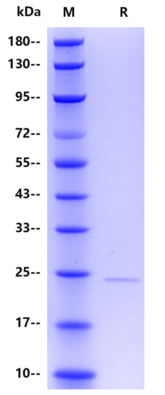 Human ferritin/FTL, His Tag