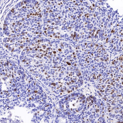 Topoisomerase II alpha Recombinant Rabbit mAb (S-513-7)