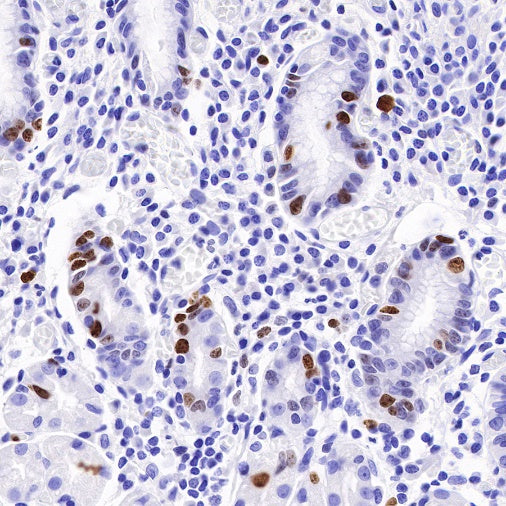 Ki67 Mouse mAb (SDT-606-33)