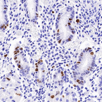 Ki67 Mouse mAb (SDT-606-33)