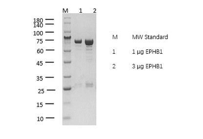 EPHB1 Protein