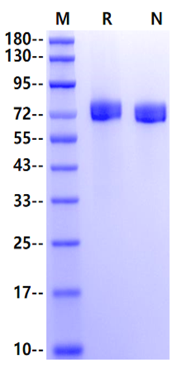 EphB2 His Tag Protein, Human