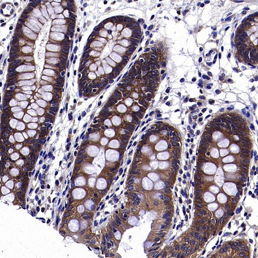 AMPKβ1/2 Recombinant Rabbit mAb (S-2728-26)