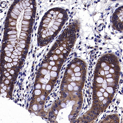 AMPKβ1/2 Recombinant Rabbit mAb (S-2728-26)