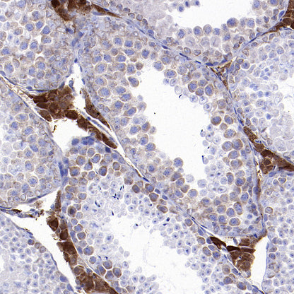 YTHDC2 Recombinant Rabbit mAb (S-3338-41)