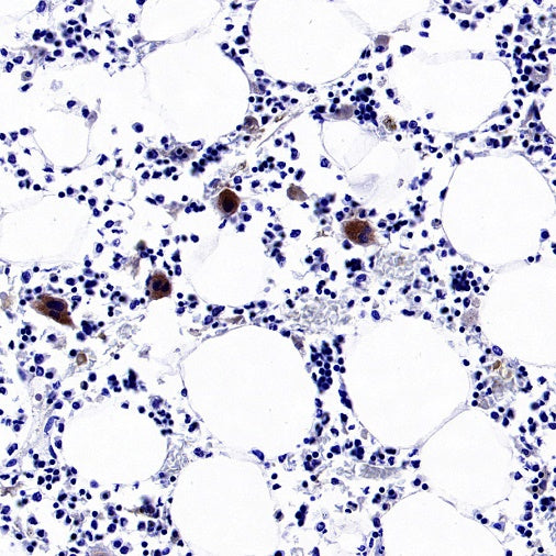 TGF beta 1 Recombinant Rabbit mAb (S-3204)