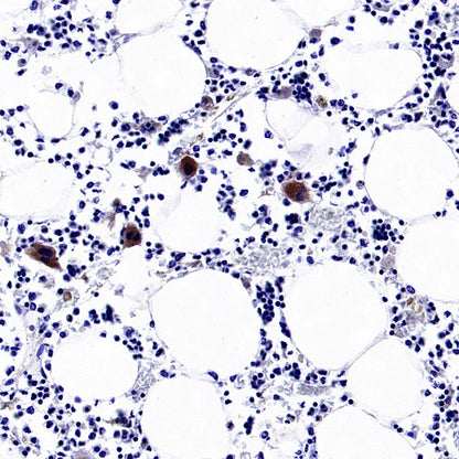 TGF beta 1 Recombinant Rabbit mAb (S-3204)