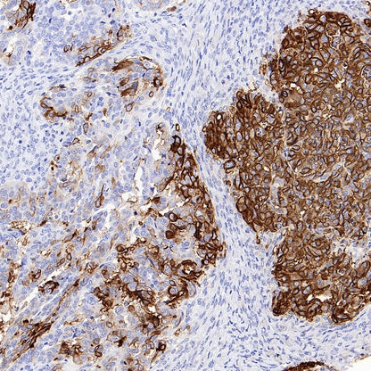 ALPP/ALPPL2 Recombinant Rabbit mAb, PBS Only (SDT-2088-32)