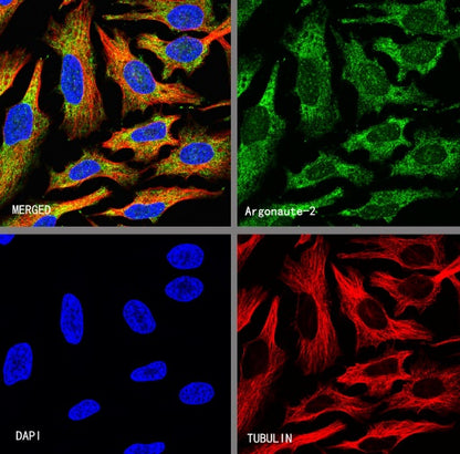 Argonaute-2 Recombinant Rabbit mAb (S-1826-47)