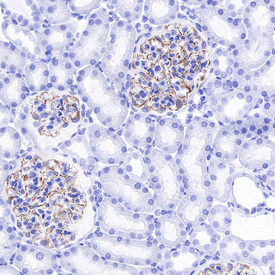 Nestin Recombinant Rabbit mAb (S-5471)