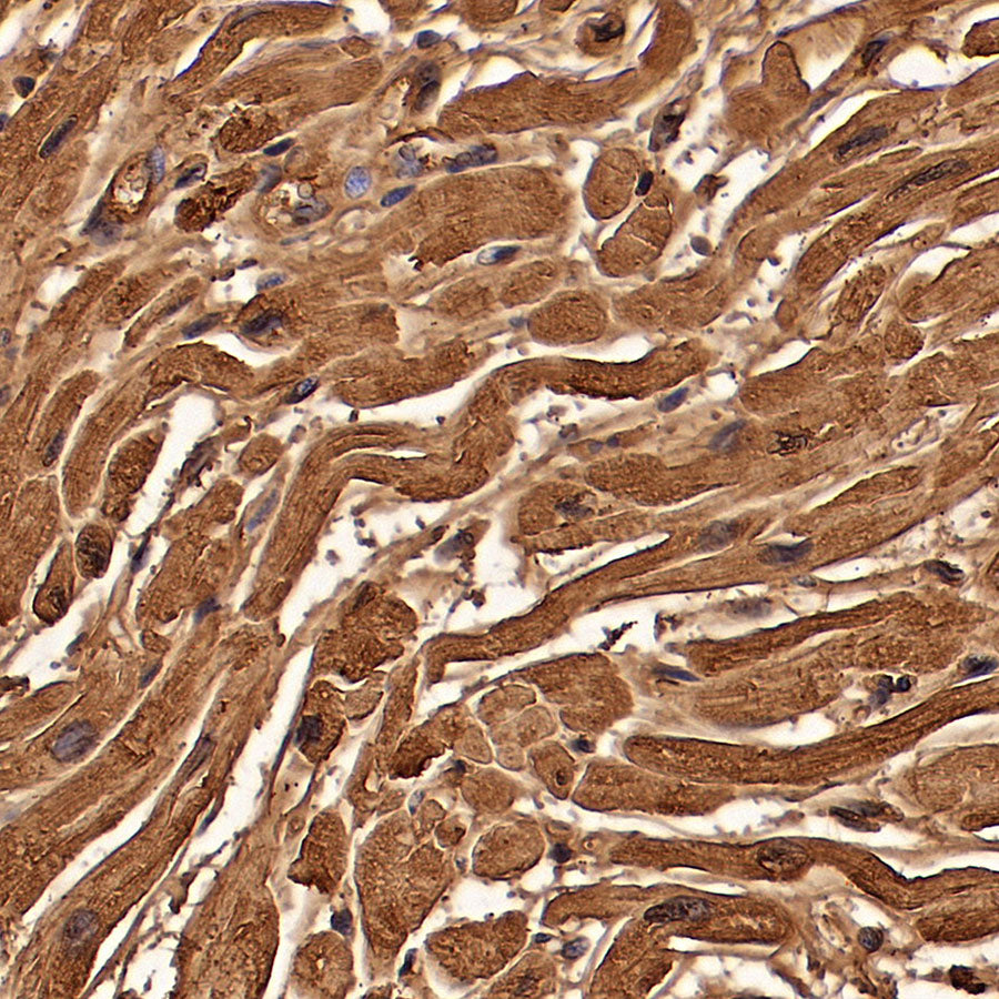 Myoglobin Recombinant Rabbit mAb (S-6197)