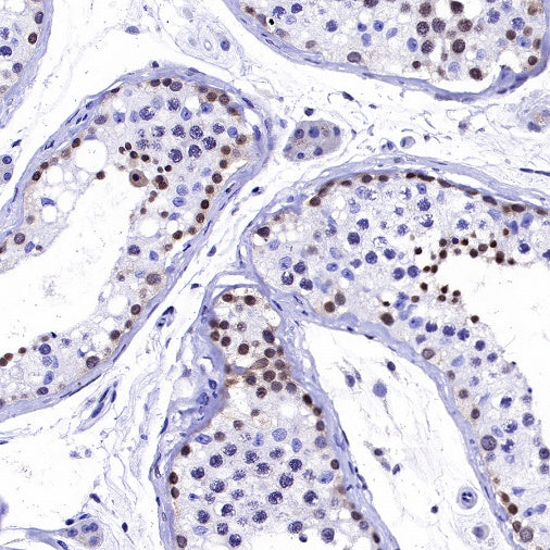 MGMT Recombinant Rabbit mAb (SDT-522-71)