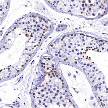 MGMT Recombinant Rabbit mAb (SDT-522-71)