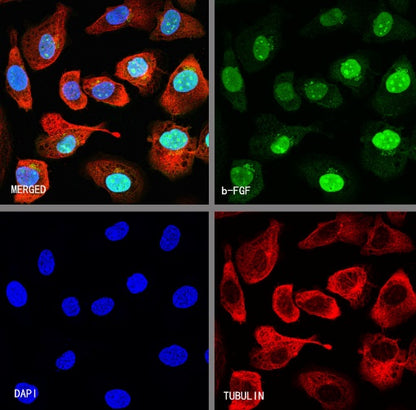 b-FGF/FGF2 Recombinant Rabbit mAb (S-1161-136)