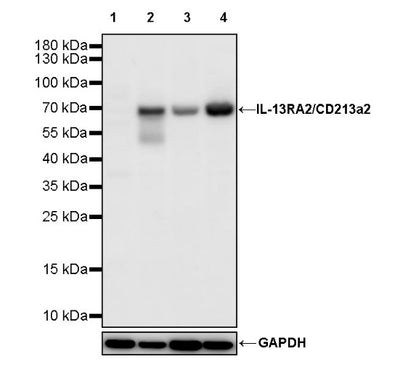 IL-13RA2/CD213a2 Rabbit Polyclonal Antibody