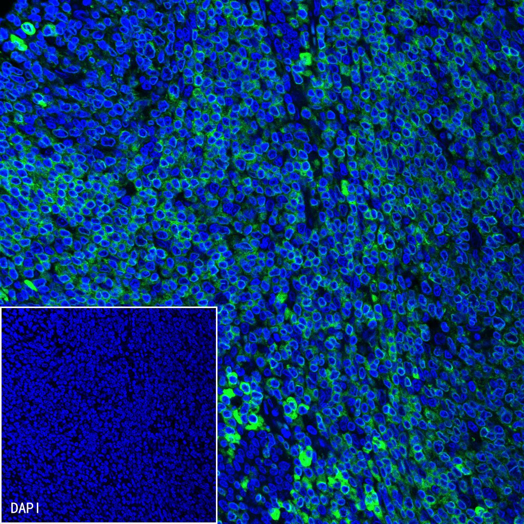 CD79a/MB-1 Recombinant Rabbit mAb (SDT-030-18)