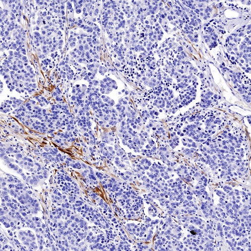 Calretinin Recombinant Rabbit mAb (SDT-2773-21)