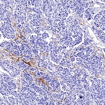 Calretinin Recombinant Rabbit mAb (SDT-2773-21)
