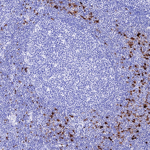 S-RMab® S100B Recombinant Rabbit mAb (SDT-518-45)
