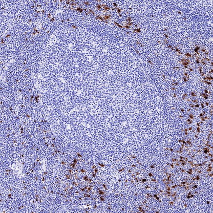 S-RMab® S100B Recombinant Rabbit mAb (SDT-518-45)