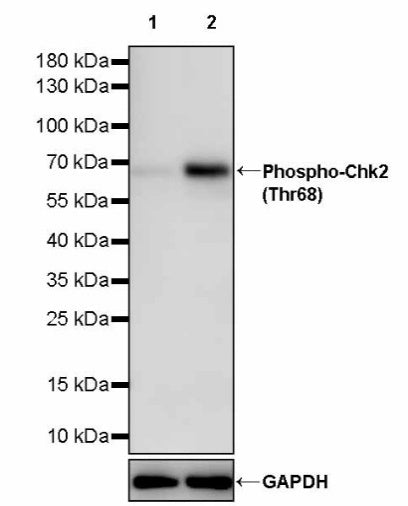 Phospho-Chk2 (Thr68) Recombinant Rabbit mAb (S-2214-11)