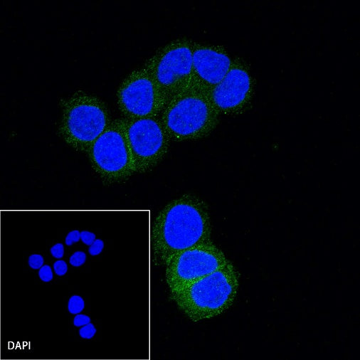 B7-H4 Recombinant Rabbit mAb (SDT-314-447-2)