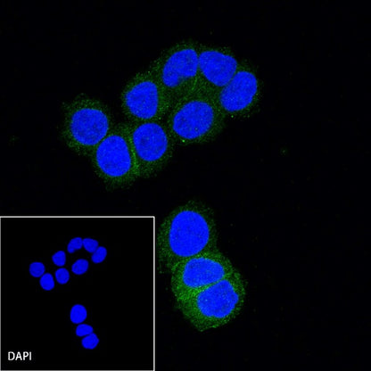 B7-H4 Recombinant Rabbit mAb (SDT-314-447-2)