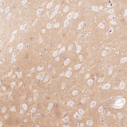 PDE4 Recombinant Rabbit mAb (S-2598-147)