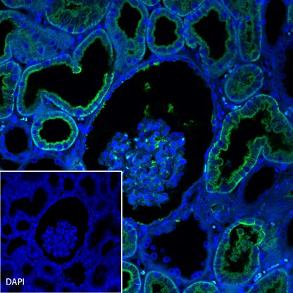 Aquaporin 1/AQP1 Recombinant Rabbit mAb (S-794-79)