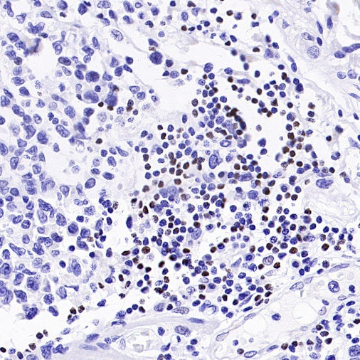 TCF1/TCF7 Recombinant Rabbit mAb (S-3486)